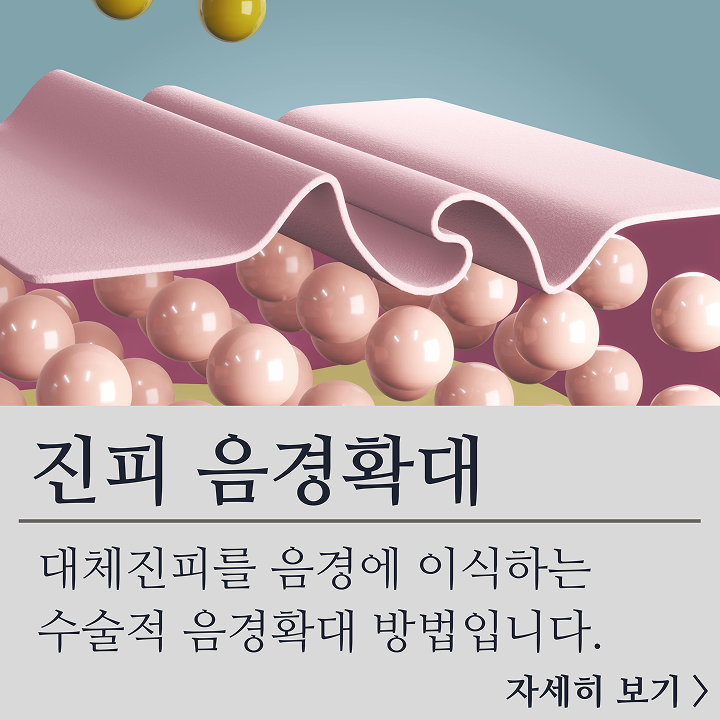 진피 음경확대